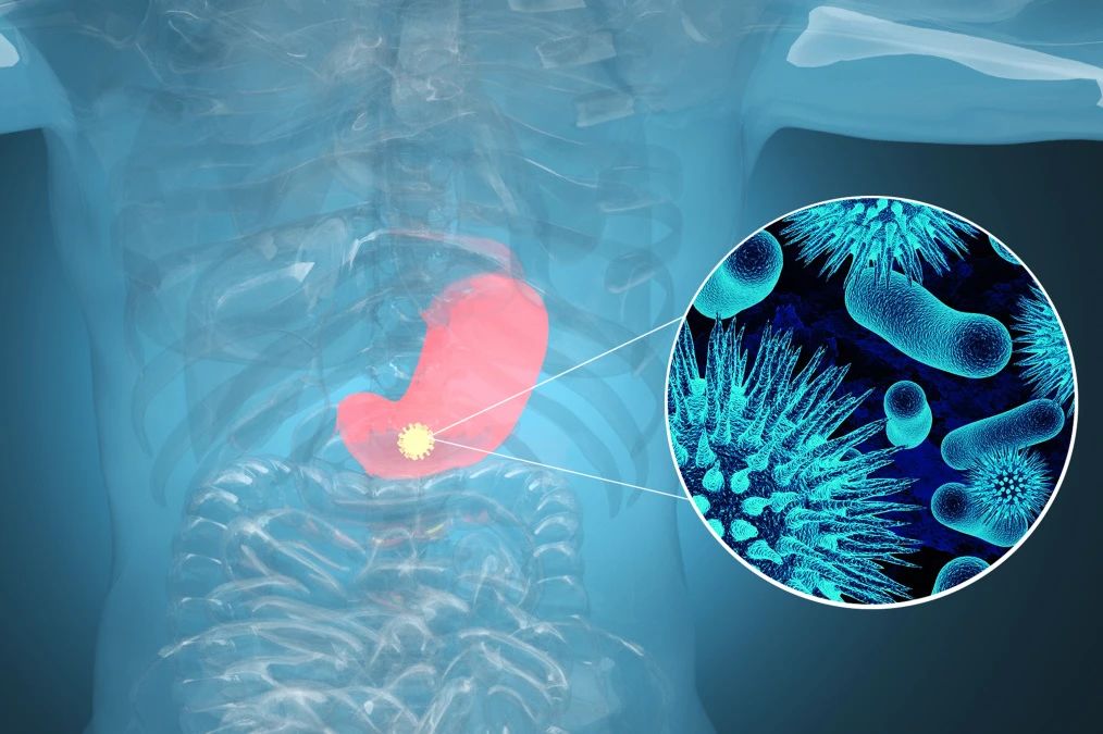 ���������CA72-4����θ�������������㻹������������������